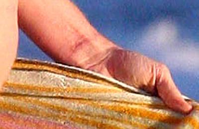 Шрамы знаменитостей