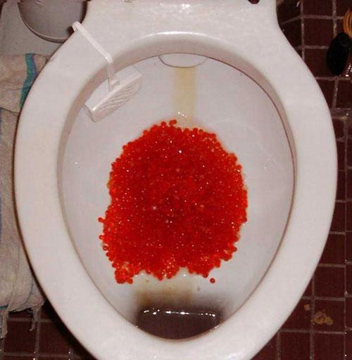 Топ фотоприколов Рунета — Задорнов отдыхает!