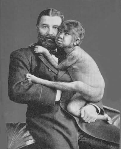 Мальчик-обезьяна на руках у благовидного отца вызывал жалость у мужчин и потоки слез у женщин...