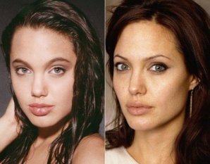 Звездные губы: Настоящие или «прокачанные»?