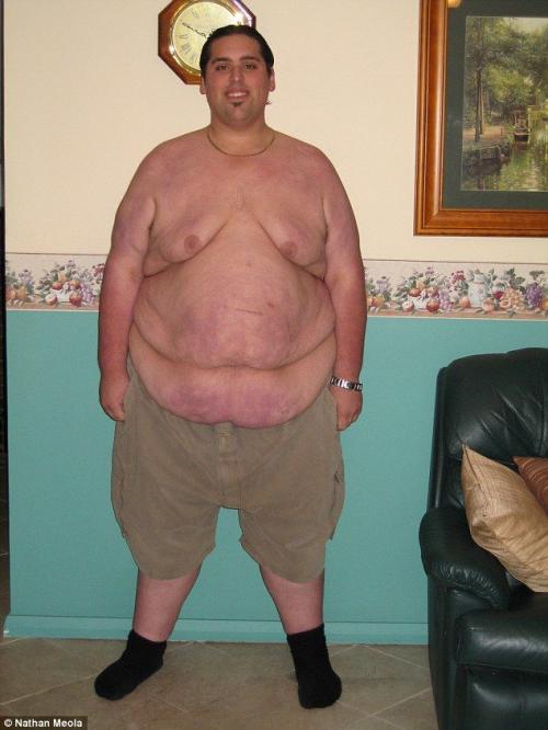 Невероятное похудение 206-килограммового парня