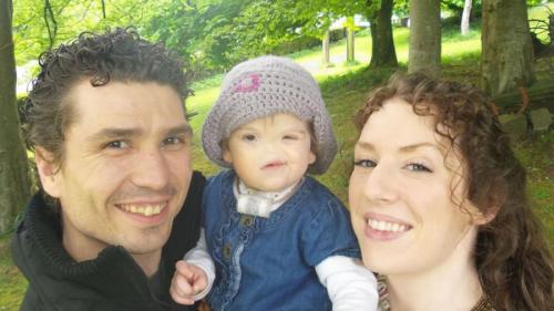 Девочку без носа ждет операция в Лондоне