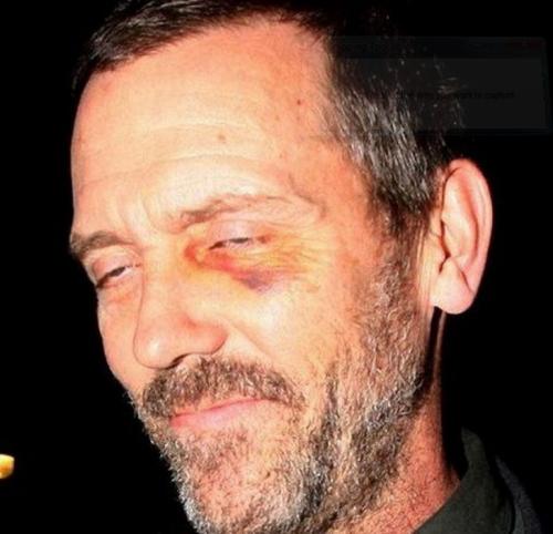 Фото знаменитостей, которые они хотели бы забыть