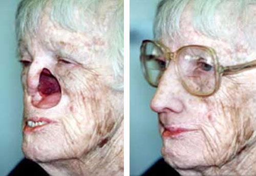 Спасённые лица: агент ЦРУ восстанавливает внешность