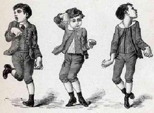 Самые странные и необъяснимые болезни в мире