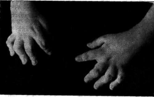 Самые странные и необъяснимые болезни в мире