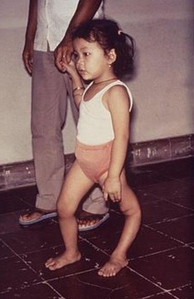 Самые странные и необъяснимые болезни в мире