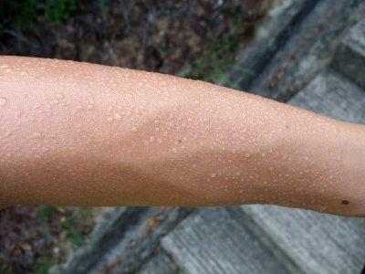 Самые странные и необъяснимые болезни в мире