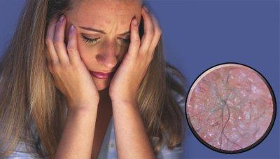 Самые странные и необъяснимые болезни в мире