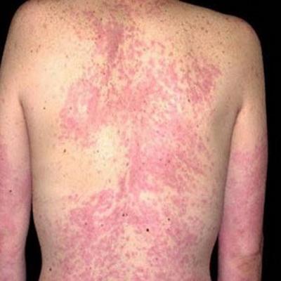 Самые странные и необъяснимые болезни в мире