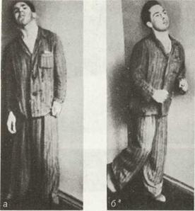 Самые странные и необъяснимые болезни в мире