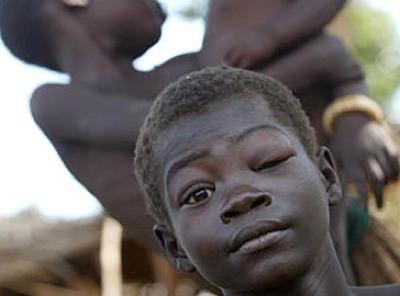 Самые странные и необъяснимые болезни в мире