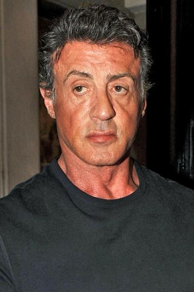 Самые известные жертвы пластической хирургии