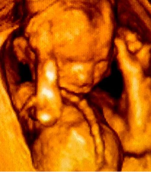 Фото детей в утробе еще до рождения. УНИКАЛЬНЫЕ СНИМКИ