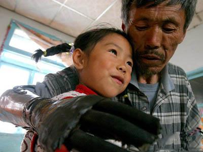 Китайский крестьянин сделал себе бионические руки