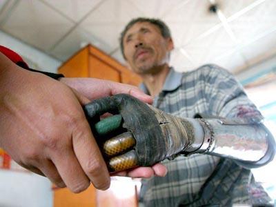Китайский крестьянин сделал себе бионические руки
