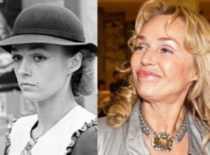 Российские знаменитости до и после пластических операций