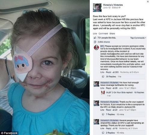 3-летнюю девочку, изуродованную питбулями, выгнали из закусочной из-за ее внешности