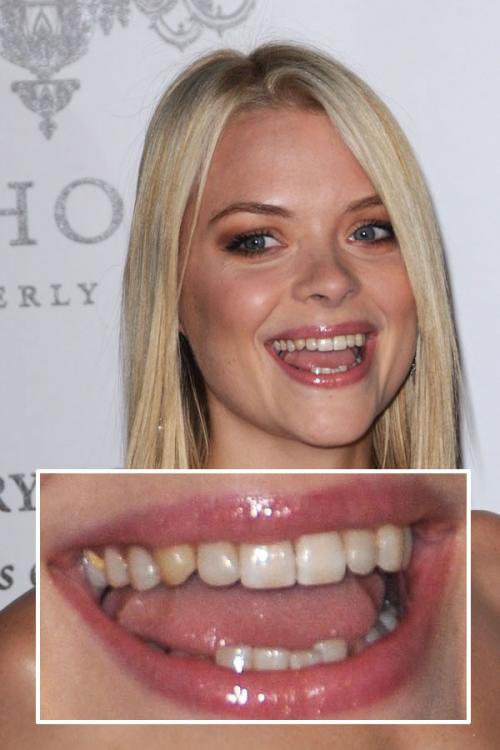 Школа злословия: звезды под микроскопом