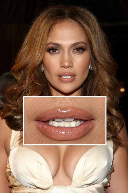 Школа злословия: звезды под микроскопом