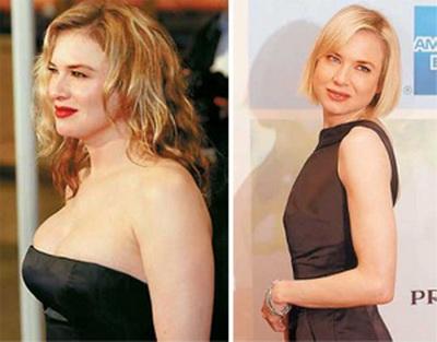 20 звезд, которые постоянно набирают вес