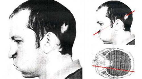 7 невероятных историй выживания людей, побывавших на волоске от смерти