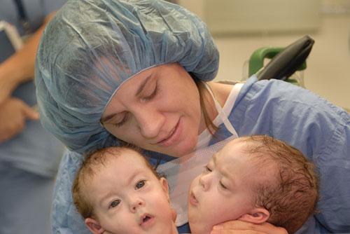 Самая удачная операция по разделению сиамских близнецов