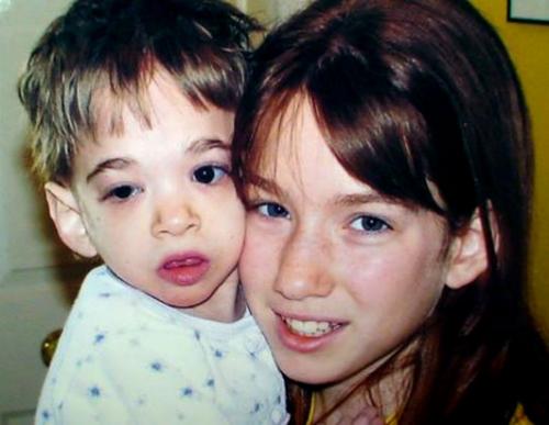 Медики впервые столкнулись с невзрослеющим ребенком