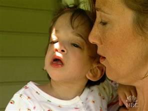 Медики впервые столкнулись с невзрослеющим ребенком