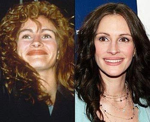 Кто бы мог подумать, что на этих снимках будущие секс-символы?!