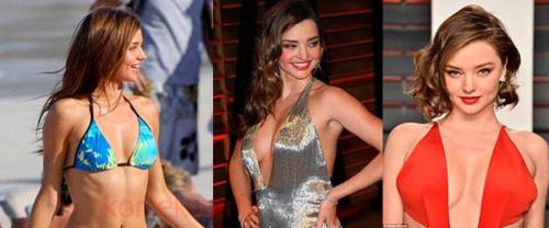 Звезды, которые признались в том, что увеличили грудь