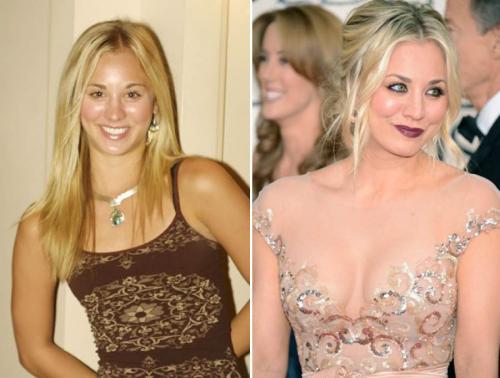 Звезды, которые признались в том, что увеличили грудь