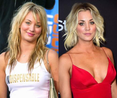 Звезды, которые признались в том, что увеличили грудь