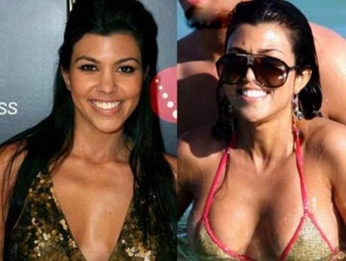 Звезды, которые признались в том, что увеличили грудь