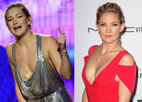 Звезды, которые признались в том, что увеличили грудь