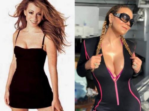 Звезды, которые признались в том, что увеличили грудь