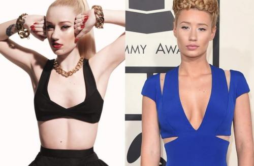 Звезды, которые признались в том, что увеличили грудь