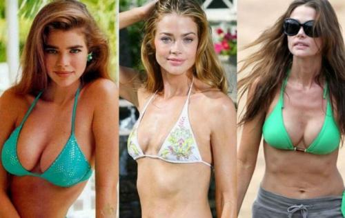 Звезды, которые признались в том, что увеличили грудь