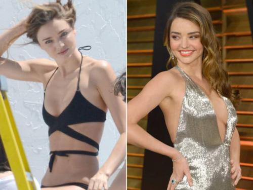 Звезды, которые признались в том, что увеличили грудь