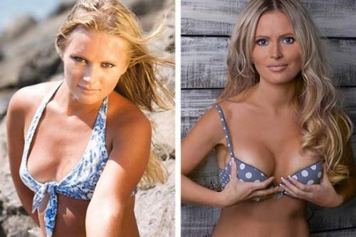 Звезды, которые признались в том, что увеличили грудь