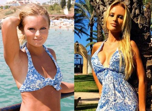 Звезды, которые признались в том, что увеличили грудь