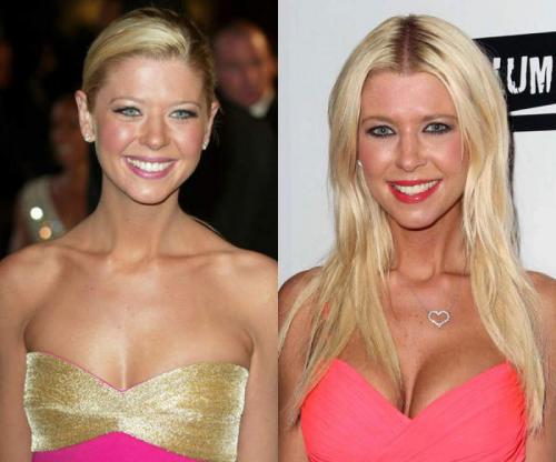 Звезды, которые признались в том, что увеличили грудь