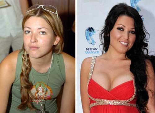 Звезды, которые признались в том, что увеличили грудь