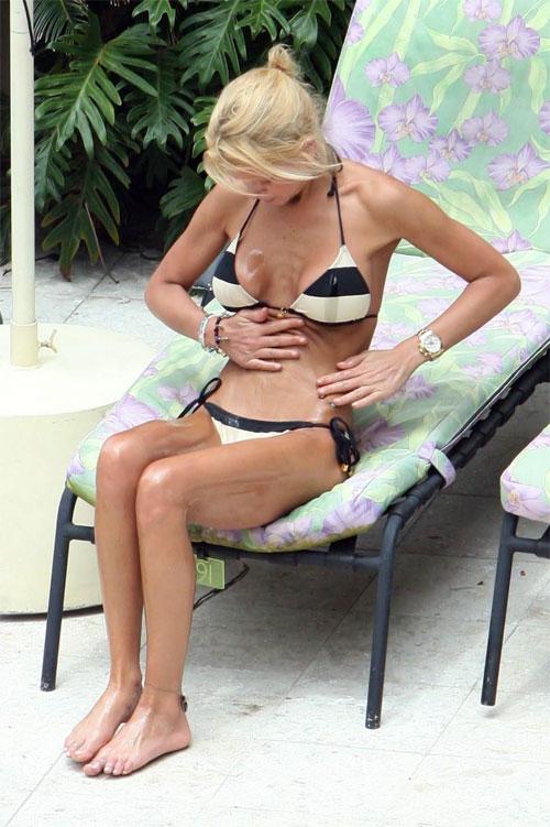 Тара Рейд продемонстрировала следы пластической хирургии