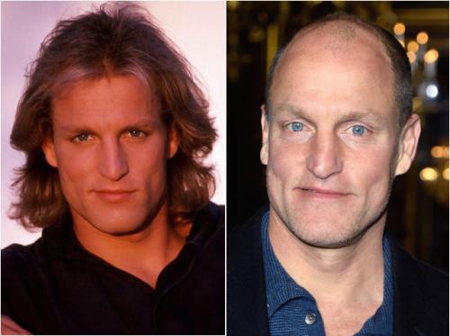 Как выглядели лысые знаменитости с шевелюрами