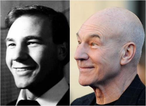 Как выглядели лысые знаменитости с шевелюрами