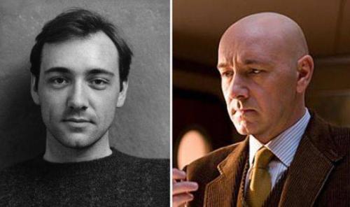 Как выглядели лысые знаменитости с шевелюрами