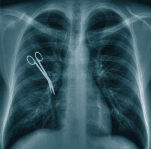 Предметы, которые можно обнаружить в человеке благодаря рентгену