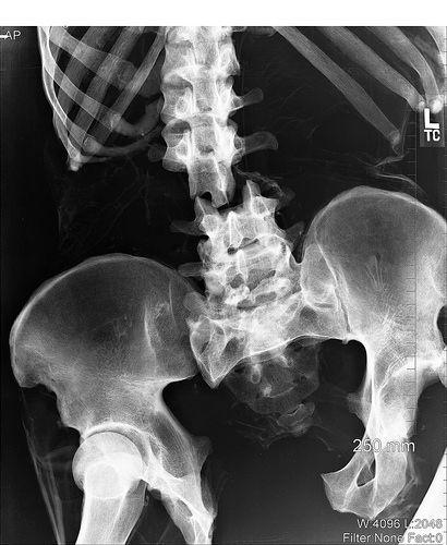 Необычные рентгеновские снимки