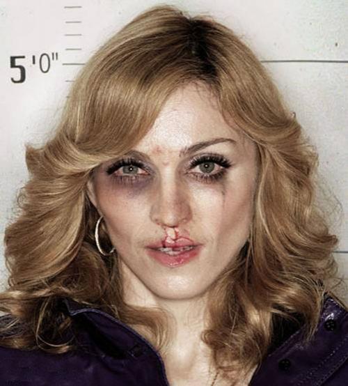 Звёздные лица, избитые в полиции